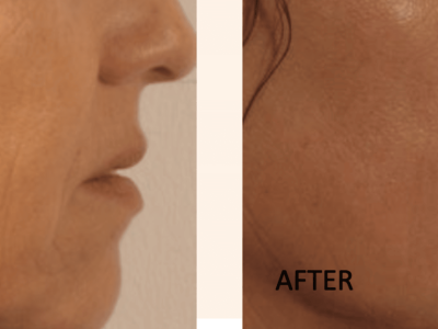 Screenshot 2025-03-04 at 5.35.02 PM-2